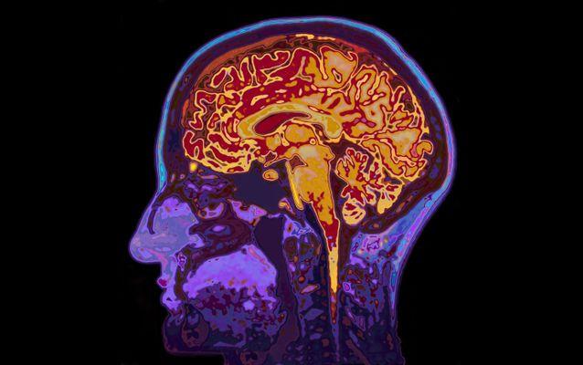 CPD: Cognitive Science for Teachers - Seneca Certified Educator